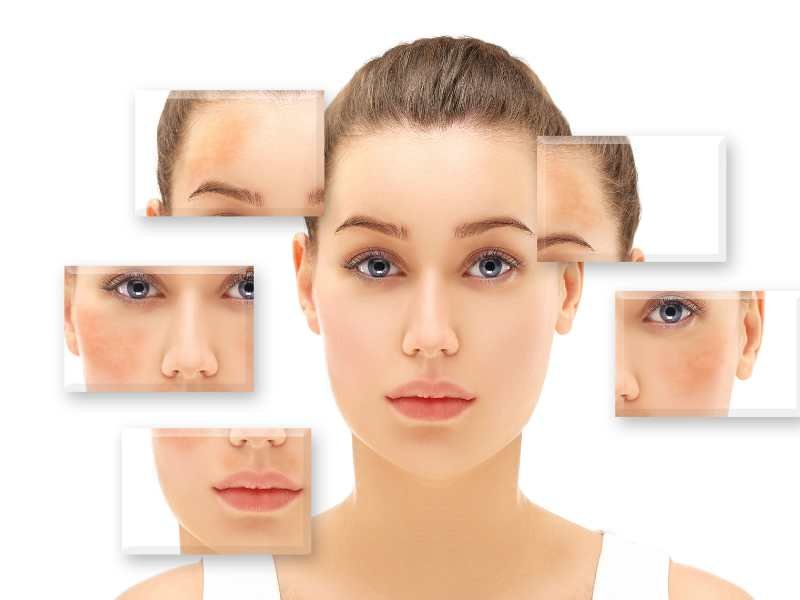 how to fade dark spots