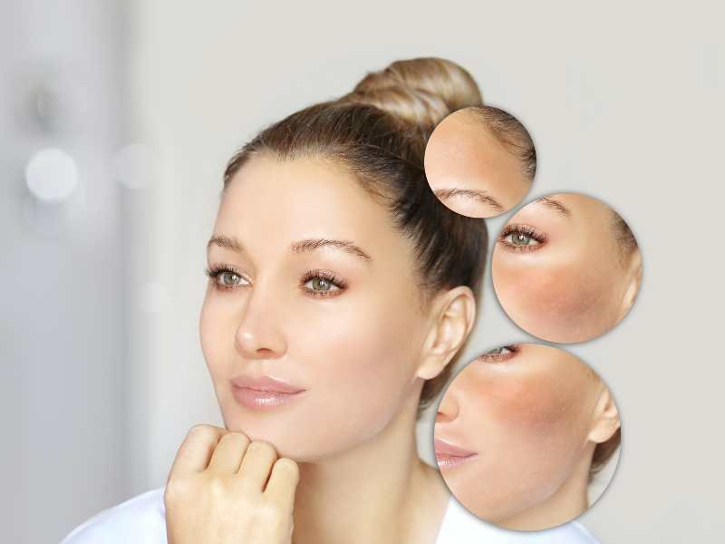how to fade dark spots