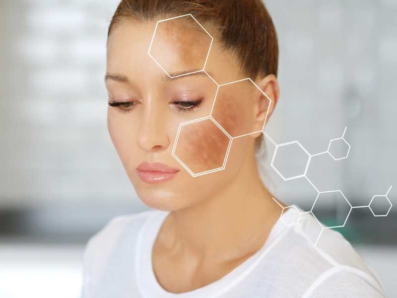 how to fade dark spots